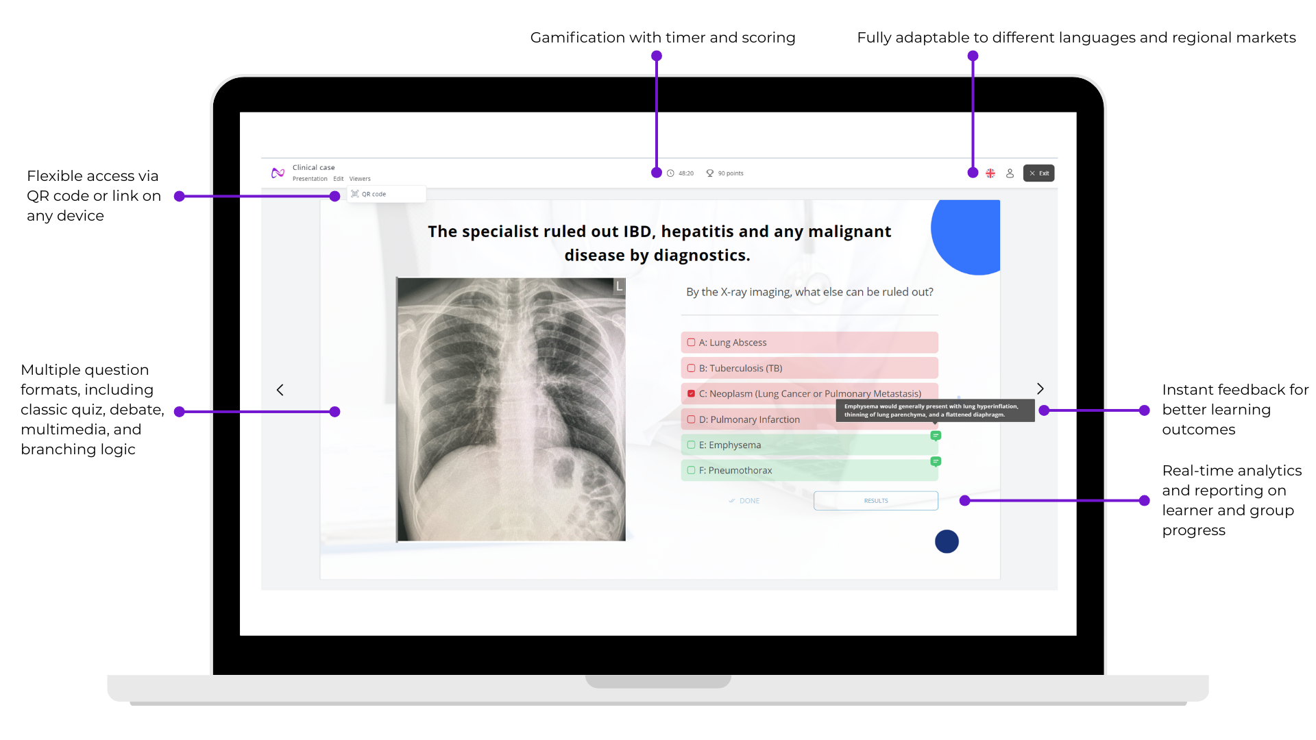 Nobula Case Creators' anatomy